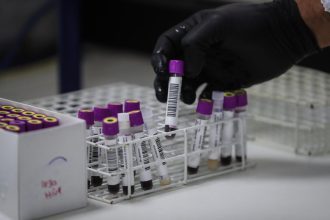 Un estudio abre la puerta a generar células madre en laboratorio para tratar la leucemia